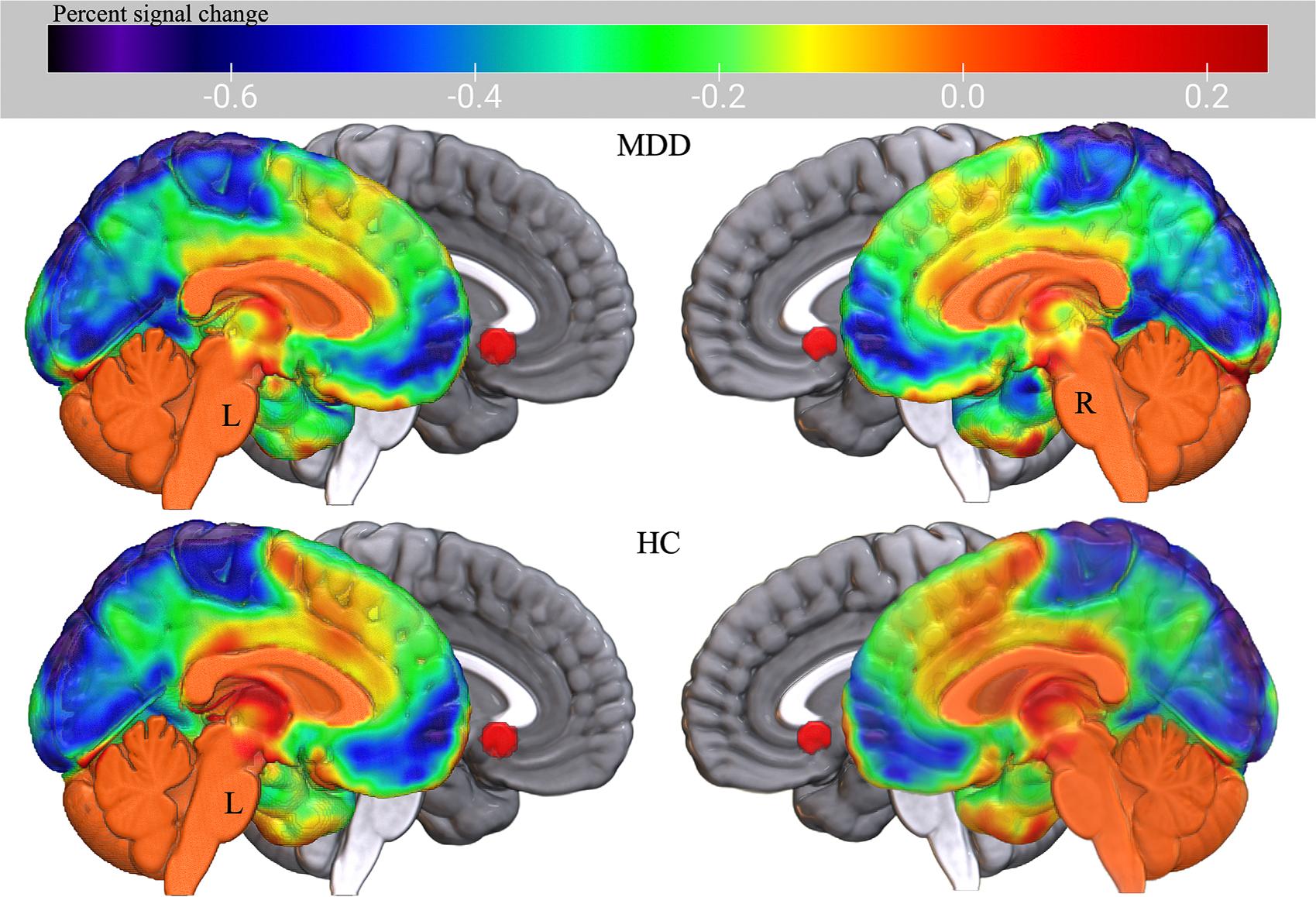 https://cdn.ncbi.nlm.nih.gov/pmc/blobs/324e/11887861/46e3fef7dd21/nihms-2047893-f0002.jpg