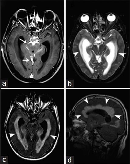 https://cdn.ncbi.nlm.nih.gov/pmc/blobs/324f/4926551/18b00e15c952/JCIS-6-24-g005.jpg