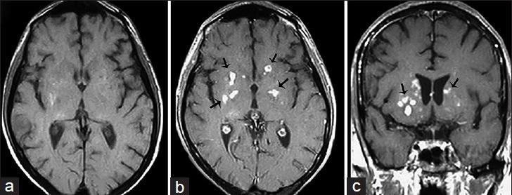 https://cdn.ncbi.nlm.nih.gov/pmc/blobs/324f/4926551/2bd9776b24c1/JCIS-6-24-g008.jpg