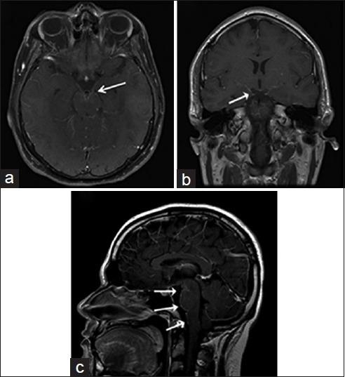 https://cdn.ncbi.nlm.nih.gov/pmc/blobs/324f/4926551/37d3c225cf11/JCIS-6-24-g002.jpg