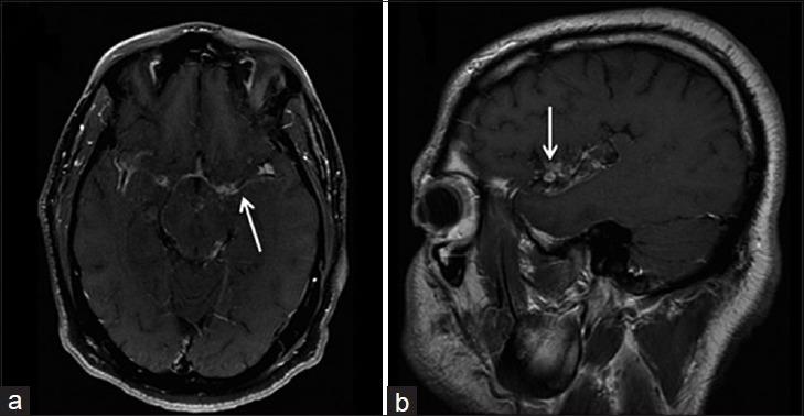 https://cdn.ncbi.nlm.nih.gov/pmc/blobs/324f/4926551/d4a3a042eb51/JCIS-6-24-g003.jpg