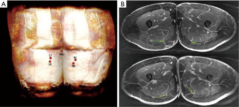 https://cdn.ncbi.nlm.nih.gov/pmc/blobs/3252/10186161/3770fed734ba/gs-12-04-516-f1.jpg
