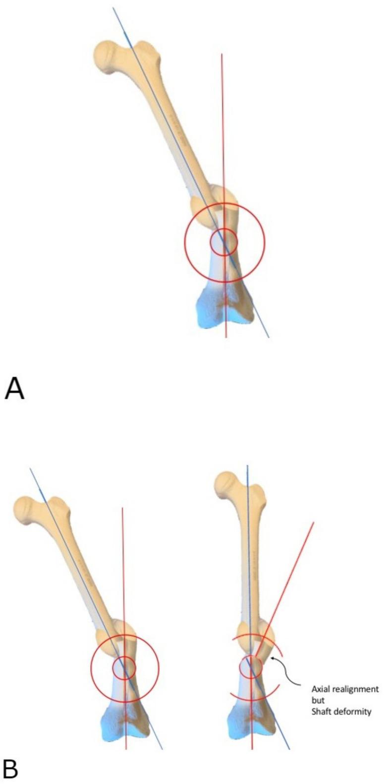 https://cdn.ncbi.nlm.nih.gov/pmc/blobs/3257/8874577/8afdc4410b09/medicina-58-00308-g005a.jpg