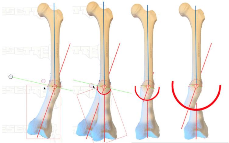 https://cdn.ncbi.nlm.nih.gov/pmc/blobs/3257/8874577/e46ee3850b25/medicina-58-00308-g004.jpg