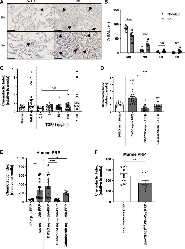 https://cdn.ncbi.nlm.nih.gov/pmc/blobs/3263/10639018/50b71d39551a/ajplung.00227.2022_f005.jpg