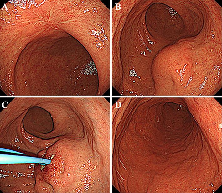 https://cdn.ncbi.nlm.nih.gov/pmc/blobs/3263/8170251/a990d16de5d7/1349-7235-60-1383-g004.jpg
