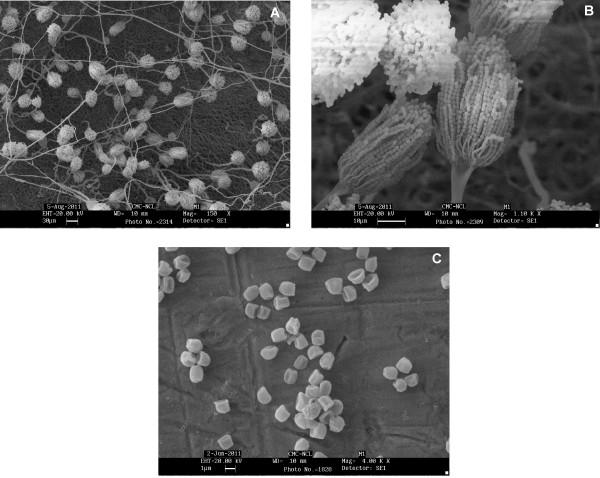 https://cdn.ncbi.nlm.nih.gov/pmc/blobs/3264/3442963/11b85dd295d4/1475-2859-11-71-3.jpg