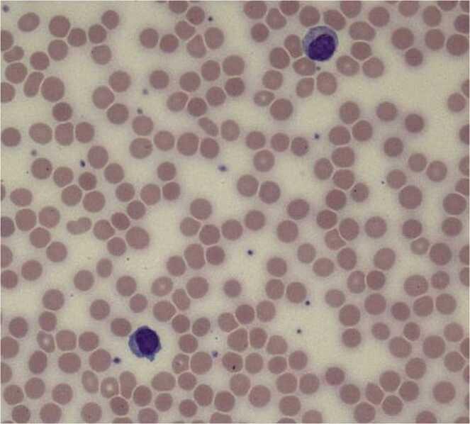 https://cdn.ncbi.nlm.nih.gov/pmc/blobs/326d/12392649/428c54a9f318/gr2.jpg