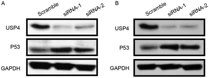 https://cdn.ncbi.nlm.nih.gov/pmc/blobs/326d/6312926/57e33cbcd7ea/ol-17-01-0958-g02.jpg