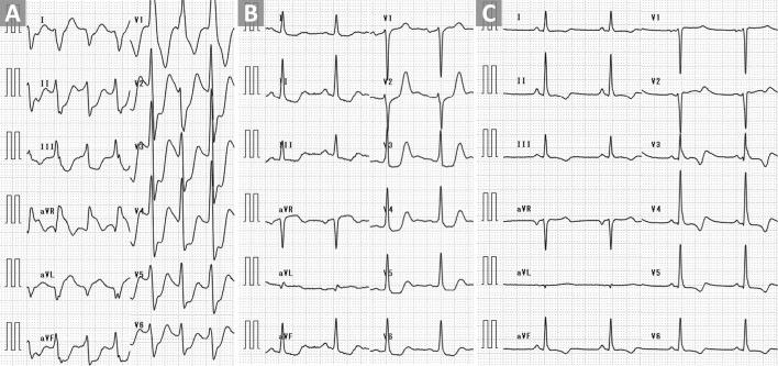https://cdn.ncbi.nlm.nih.gov/pmc/blobs/3270/11671179/89609d5257f8/1349-7235-63-3189-g001.jpg