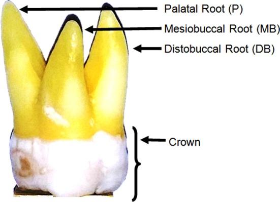 https://cdn.ncbi.nlm.nih.gov/pmc/blobs/3277/4476355/8b39ad16e64c/PJMS-31-426-g002.jpg
