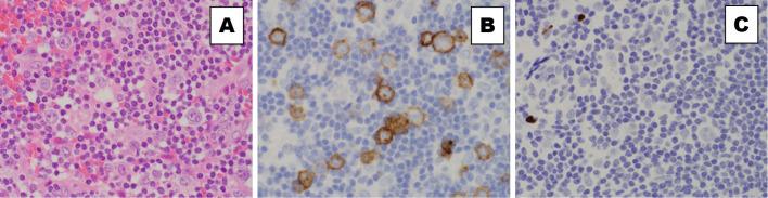 https://cdn.ncbi.nlm.nih.gov/pmc/blobs/327a/8580765/e2bad27438af/1349-7235-60-3305-g001.jpg