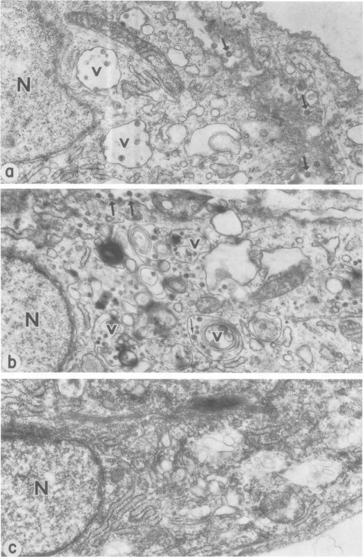 https://cdn.ncbi.nlm.nih.gov/pmc/blobs/3280/354765/8b6decee0807/jvirol00238-0284-a.jpg