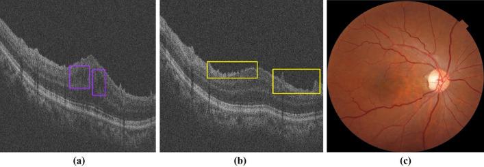 https://cdn.ncbi.nlm.nih.gov/pmc/blobs/3281/9301845/62ec0ec6f9f7/12938_2022_1018_Fig1_HTML.jpg
