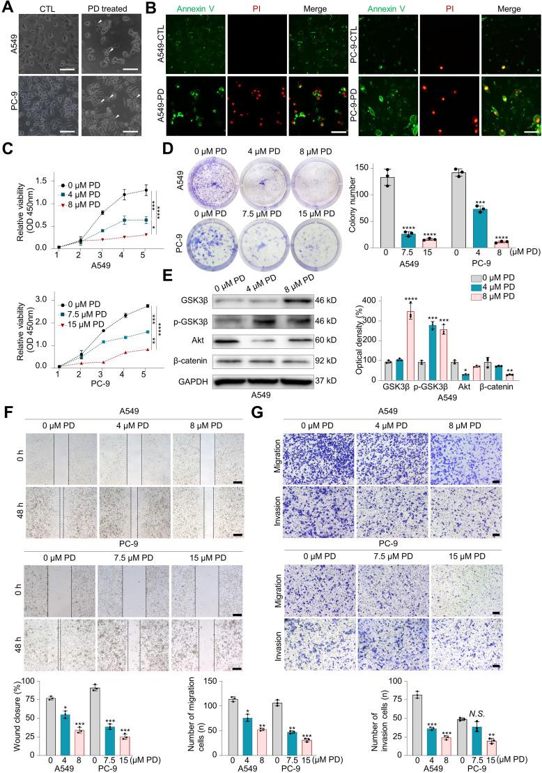 https://cdn.ncbi.nlm.nih.gov/pmc/blobs/3282/11809235/08bbdae26d41/IJN-20-1661-g0001.jpg