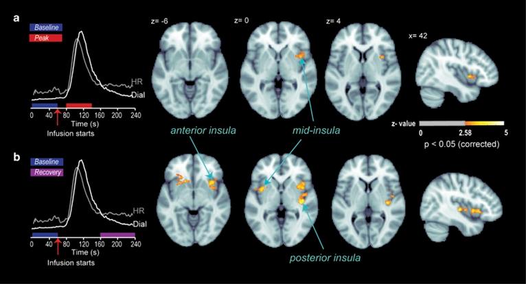 https://cdn.ncbi.nlm.nih.gov/pmc/blobs/3283/5729563/2ff9ed7ec85d/npp2017154f3.jpg