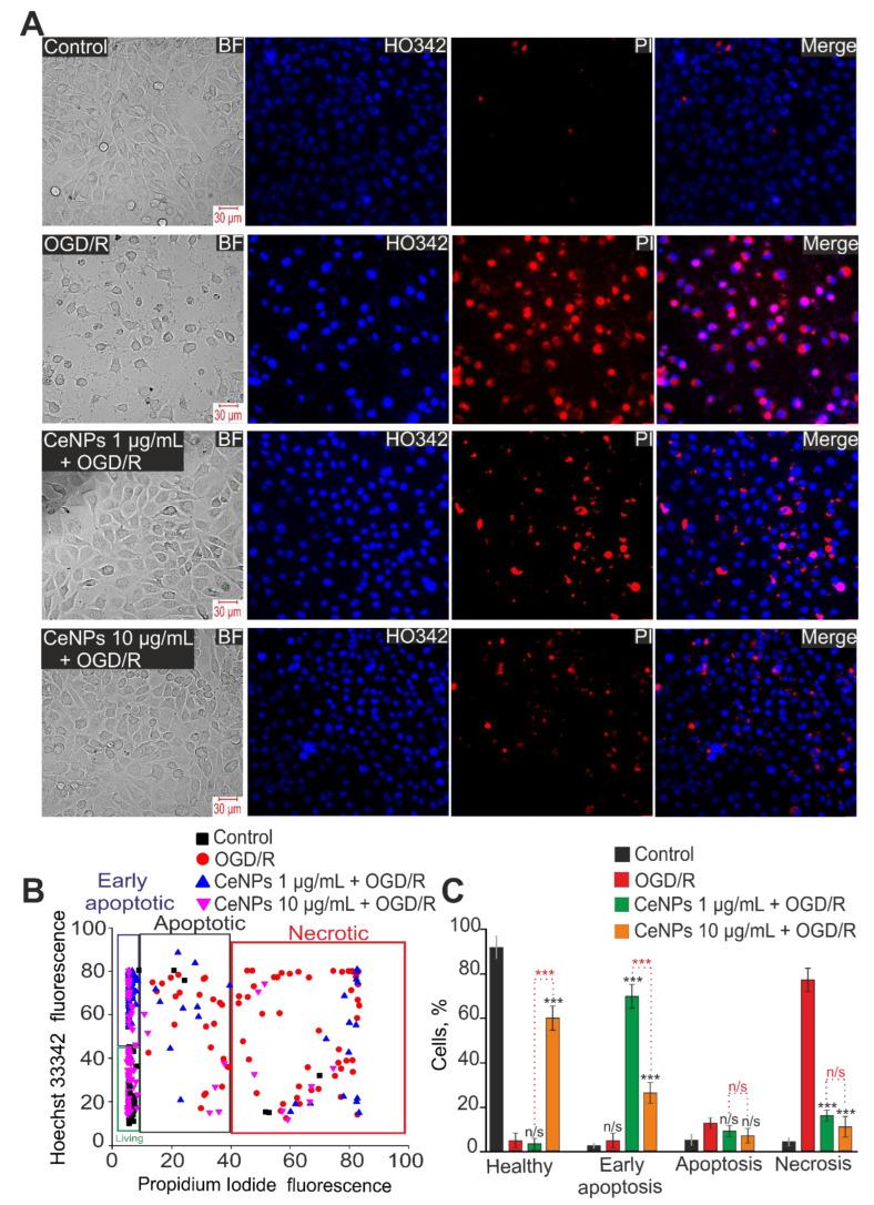 https://cdn.ncbi.nlm.nih.gov/pmc/blobs/3285/10531718/fb5210b91915/ijms-24-14305-g006.jpg
