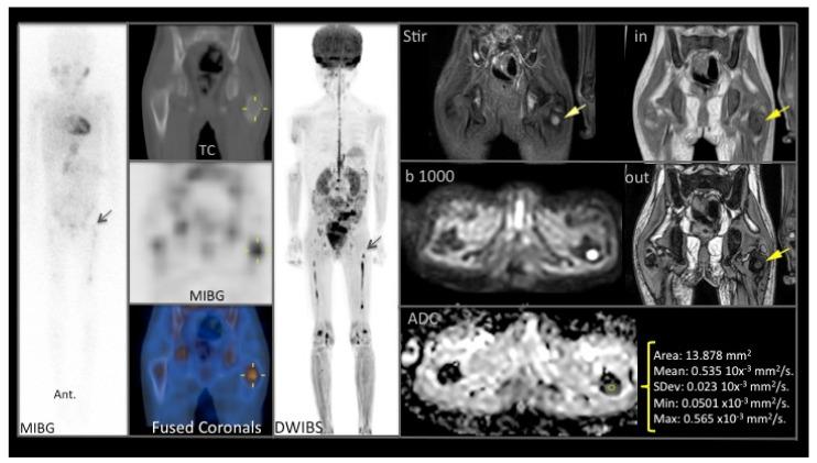https://cdn.ncbi.nlm.nih.gov/pmc/blobs/328c/7998131/81ddd062c460/cancers-13-01264-g003.jpg