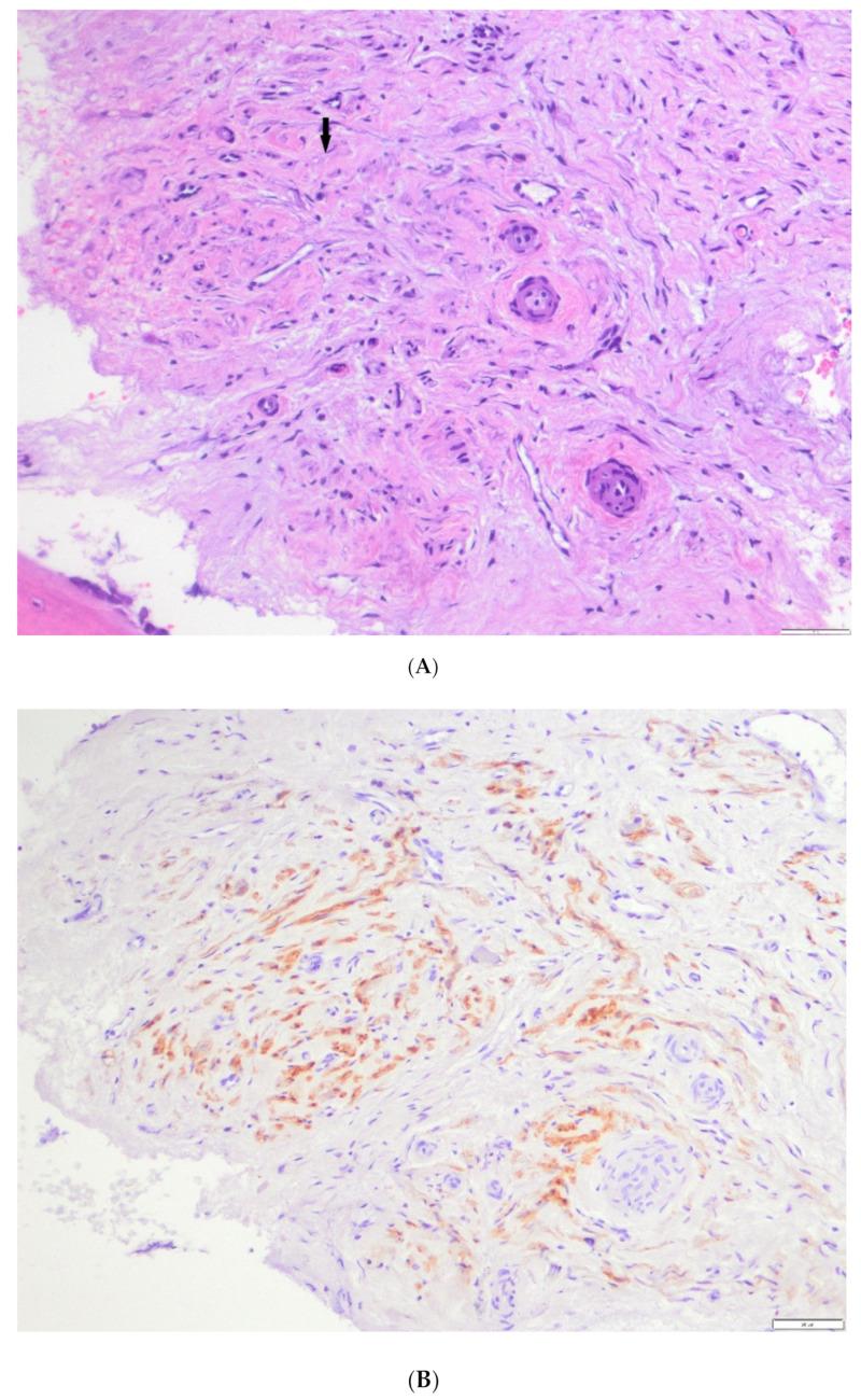 https://cdn.ncbi.nlm.nih.gov/pmc/blobs/328c/7998131/e028ea38c575/cancers-13-01264-g006.jpg