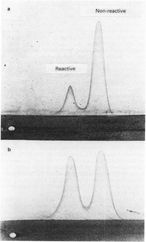 https://cdn.ncbi.nlm.nih.gov/pmc/blobs/3291/2002189/6f63796beebf/brjcancer00508-0121-a.jpg