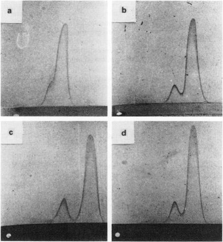 https://cdn.ncbi.nlm.nih.gov/pmc/blobs/3291/2002189/e63d5688a941/brjcancer00508-0120-a.jpg