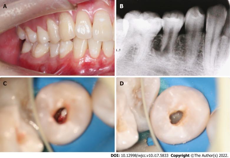 https://cdn.ncbi.nlm.nih.gov/pmc/blobs/3295/9258393/3d0ae2224c19/WJCC-10-5833-g001.jpg