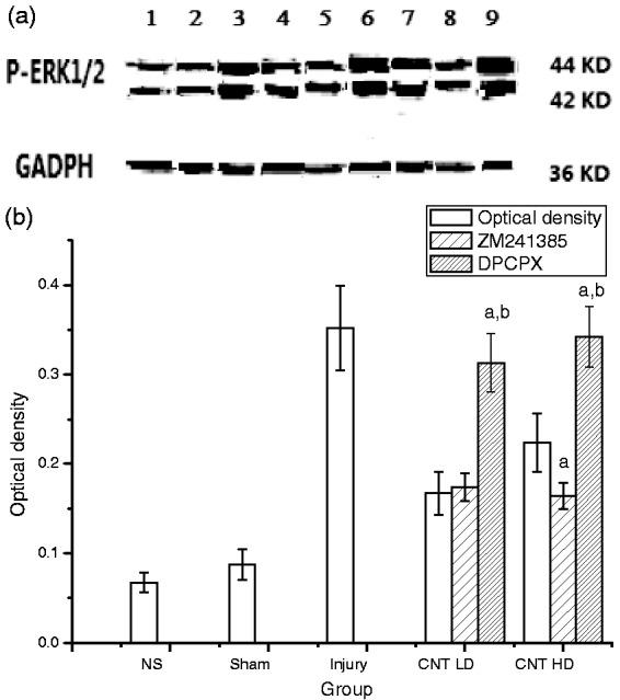 https://cdn.ncbi.nlm.nih.gov/pmc/blobs/3298/5542074/05561d99c2ca/10.1177_1744806917720336-fig3.jpg