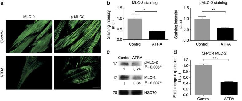 https://cdn.ncbi.nlm.nih.gov/pmc/blobs/329a/5023948/79410a7f73e2/ncomms12630-f4.jpg