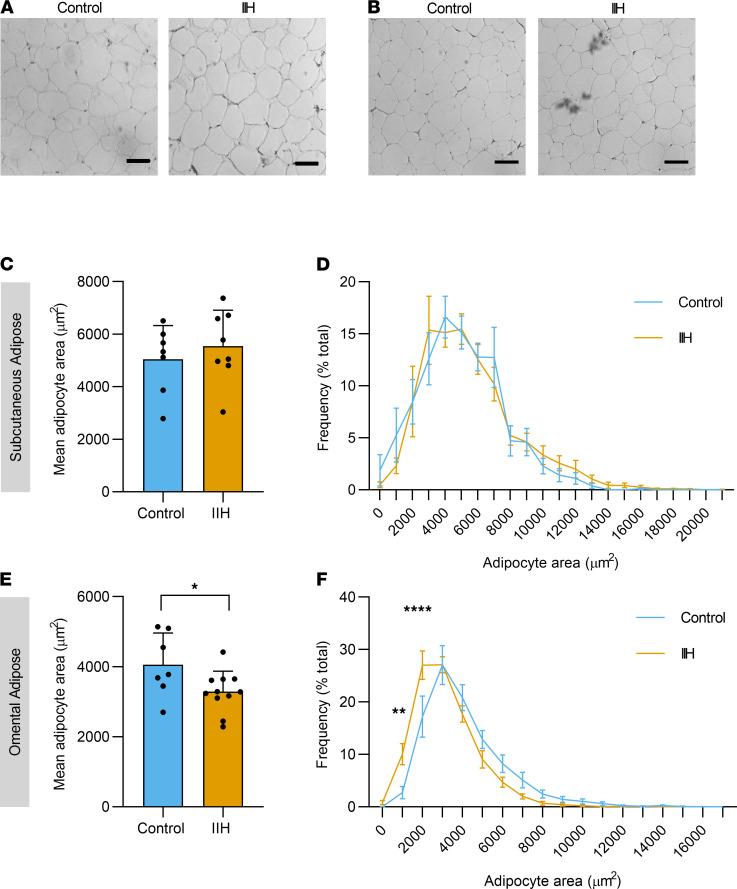 https://cdn.ncbi.nlm.nih.gov/pmc/blobs/329d/8262372/8cc9e173f761/jciinsight-6-145346-g004.jpg