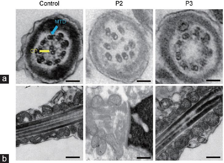 https://cdn.ncbi.nlm.nih.gov/pmc/blobs/329e/11949454/a58ee433194e/AJA-27-189-g003.jpg