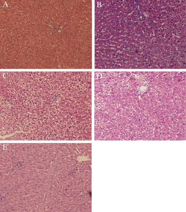 https://cdn.ncbi.nlm.nih.gov/pmc/blobs/32a2/3655894/755884b71861/1471-230X-13-79-3.jpg