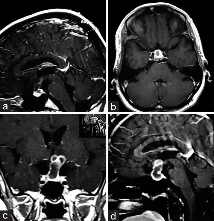 https://cdn.ncbi.nlm.nih.gov/pmc/blobs/32a9/9479561/935a3395009a/SNI-13-368-g002.jpg