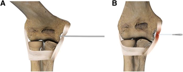 https://cdn.ncbi.nlm.nih.gov/pmc/blobs/32b0/12177358/26a242fc4594/gr4.jpg