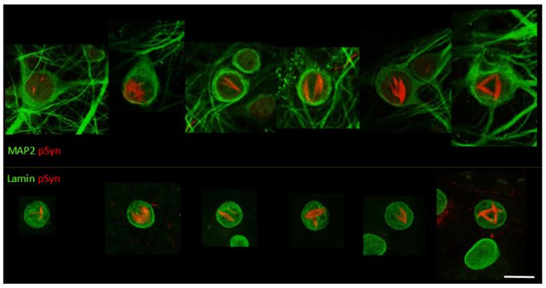 https://cdn.ncbi.nlm.nih.gov/pmc/blobs/32ba/8946814/addd4b7cad6a/biomolecules-12-00436-g004.jpg