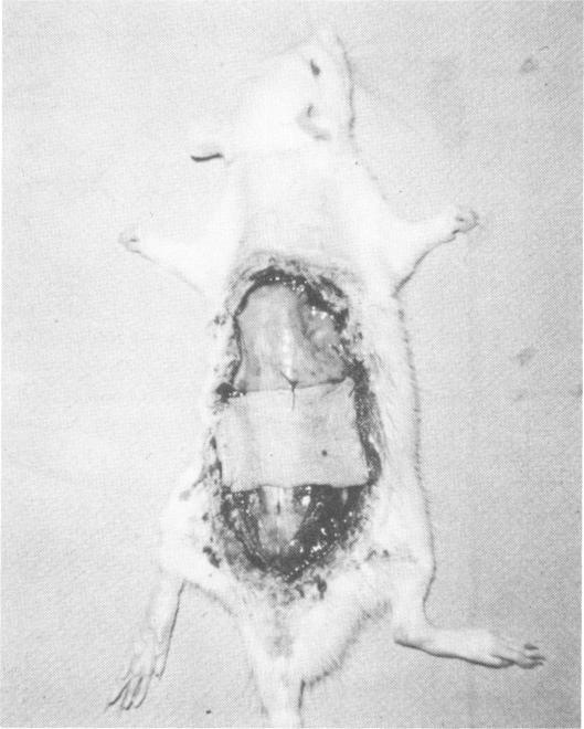https://cdn.ncbi.nlm.nih.gov/pmc/blobs/32bc/1355552/30aa996744a9/annsurg00252-0017-a.jpg