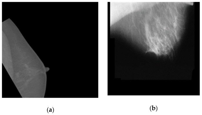 https://cdn.ncbi.nlm.nih.gov/pmc/blobs/32bf/8909211/0db323a8b648/cancers-14-01280-g005.jpg