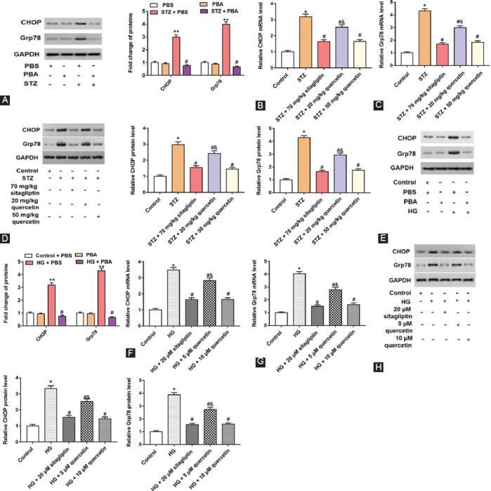 https://cdn.ncbi.nlm.nih.gov/pmc/blobs/32c2/8977087/097d0ac39201/BJBMS-22-191-g005.jpg