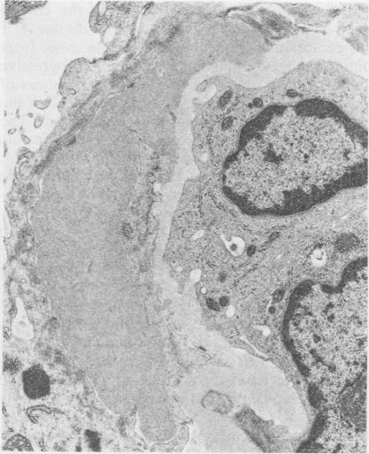 https://cdn.ncbi.nlm.nih.gov/pmc/blobs/32c3/498674/34f372ee3cf4/jclinpath00173-0071-a.jpg