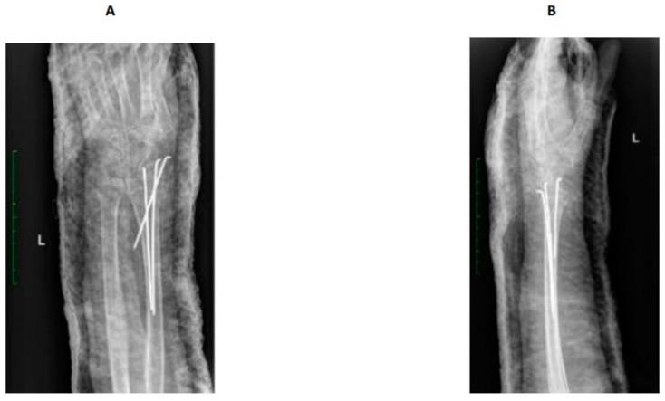 https://cdn.ncbi.nlm.nih.gov/pmc/blobs/32c8/10889771/568d106e8f4f/jcm-13-01122-g001.jpg