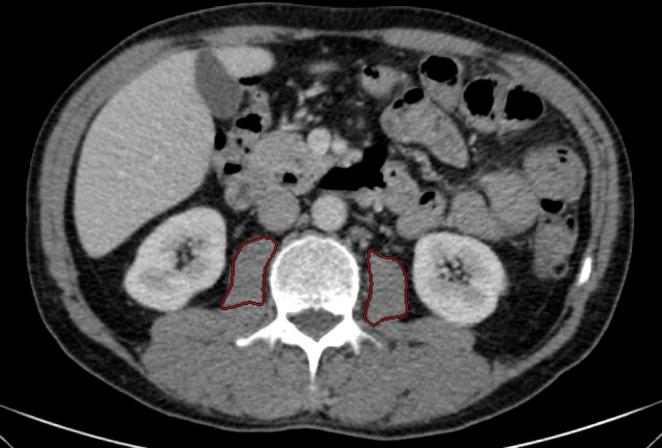 https://cdn.ncbi.nlm.nih.gov/pmc/blobs/32c9/12246956/1f45af6f891e/JCSM-16-e70012-g001.jpg