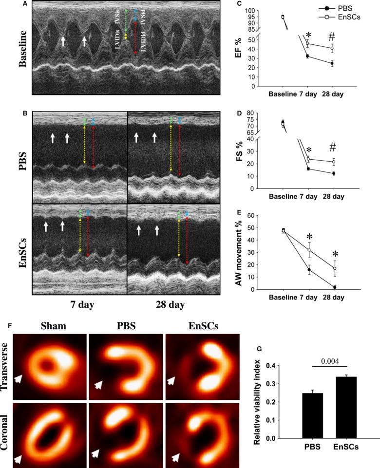 https://cdn.ncbi.nlm.nih.gov/pmc/blobs/32c9/4159016/ac62d439bdfe/jcmm0017-1247-f2.jpg