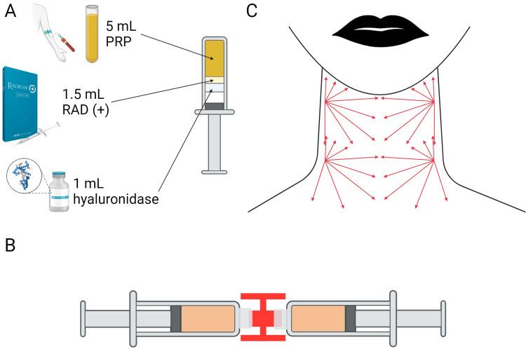 https://cdn.ncbi.nlm.nih.gov/pmc/blobs/32cc/11299635/4e992a410f2e/cureus-0016-00000063969-i01.jpg