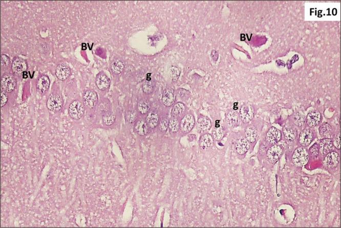 https://cdn.ncbi.nlm.nih.gov/pmc/blobs/32cd/7527115/85ff640adf2b/ACB-53-330-f10.jpg