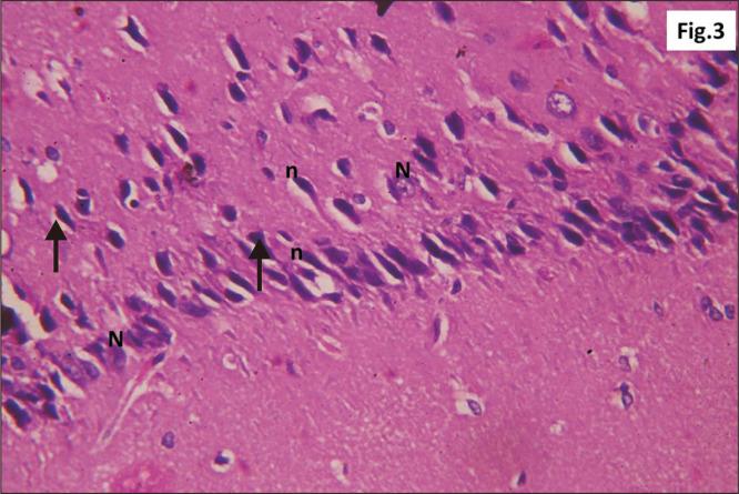 https://cdn.ncbi.nlm.nih.gov/pmc/blobs/32cd/7527115/b93a76500ab6/ACB-53-330-f3.jpg