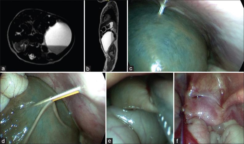 https://cdn.ncbi.nlm.nih.gov/pmc/blobs/32ce/8109755/0a88423c487d/AJPS-18-9-g001.jpg