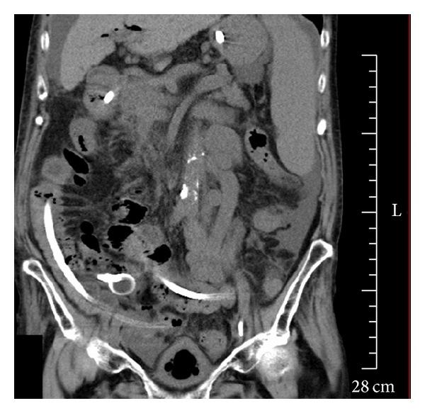https://cdn.ncbi.nlm.nih.gov/pmc/blobs/32d8/4195353/1f748892355a/CRIGM2014-271571.006.jpg