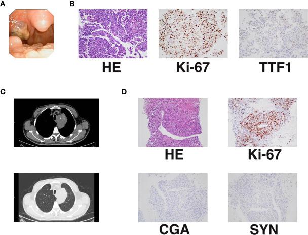 https://cdn.ncbi.nlm.nih.gov/pmc/blobs/32d9/8264298/2a5910c4de16/fonc-11-680818-g001.jpg