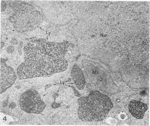 https://cdn.ncbi.nlm.nih.gov/pmc/blobs/32df/2042434/a9b6de891670/amjpathol00240-0285-a.jpg
