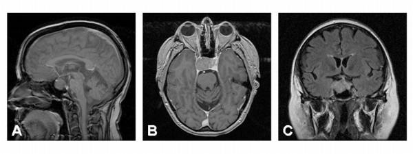 https://cdn.ncbi.nlm.nih.gov/pmc/blobs/32e3/2678126/cfb6dbcc8c04/1477-7819-7-39-1.jpg