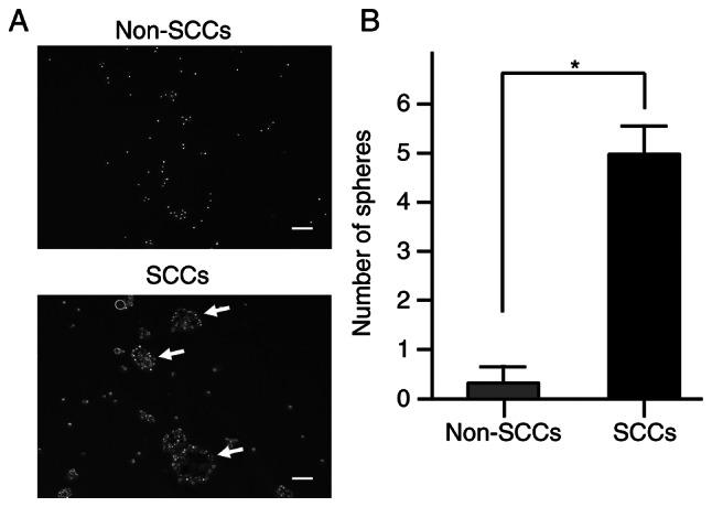 https://cdn.ncbi.nlm.nih.gov/pmc/blobs/32e3/9529430/1c8b8629c39e/IJO-61-5-05428-g01.jpg
